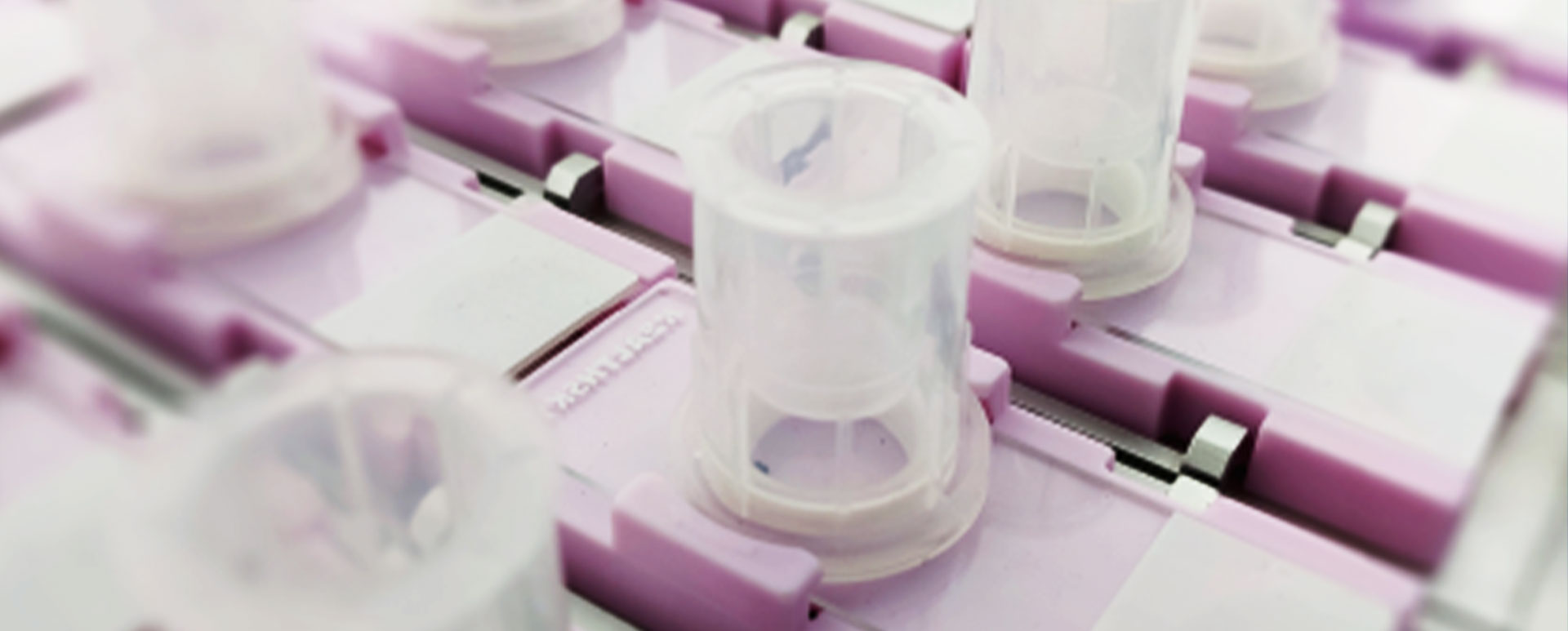 액체 기반 세포학 키트