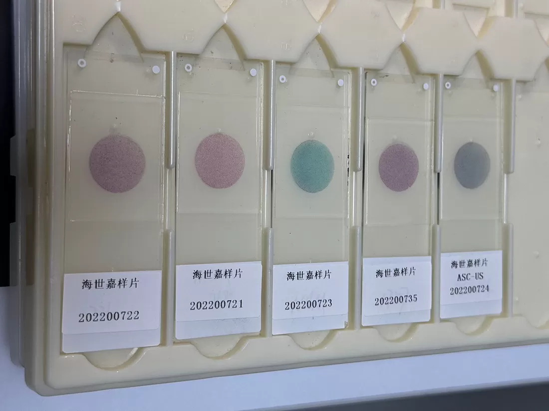 Pap Stain 결과를 올바르게 해석하는 방법