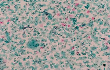 스테인드 슬라이드의 페이딩에 영향을 미치는 요인